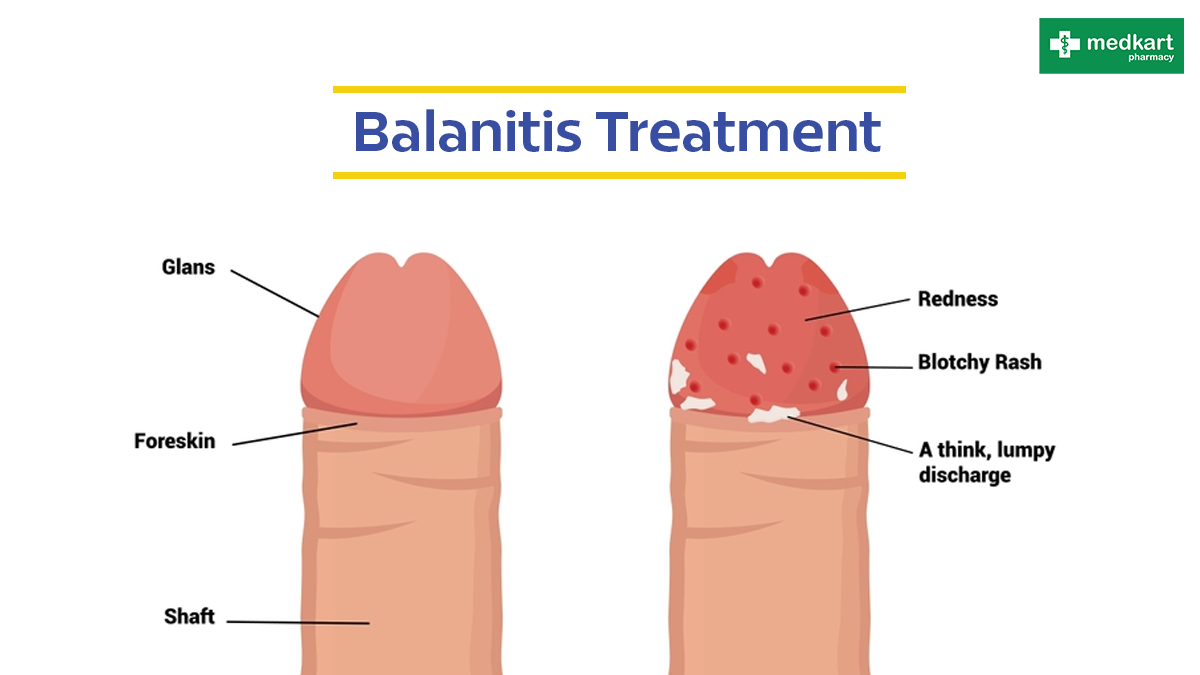 Medicine for penile infection discount