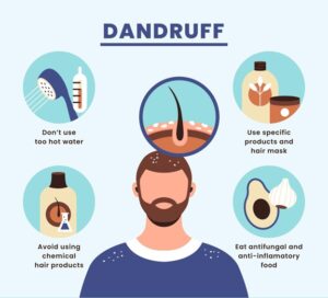 Dandruff Treatment