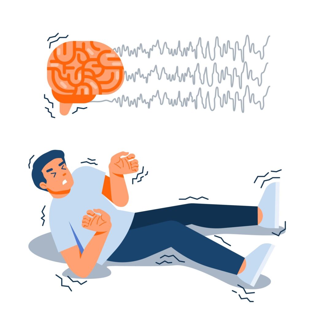 Epilepsy Treatment in Hindi