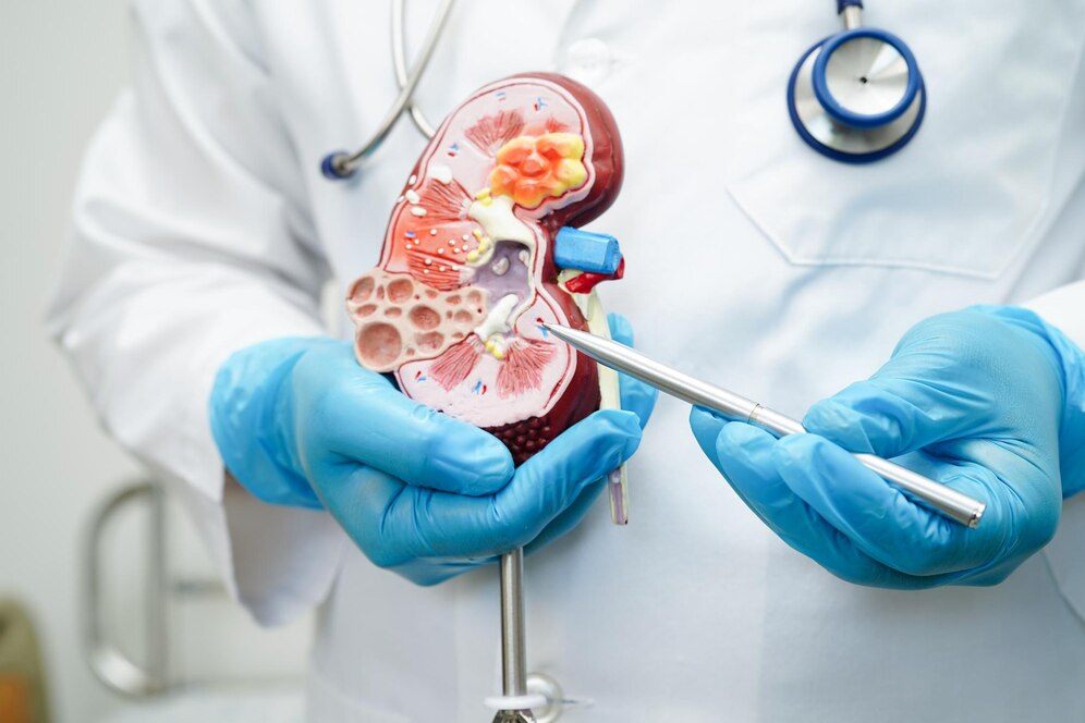 Kidney Stones Treatment