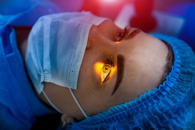 Laser Treatment For Eyes