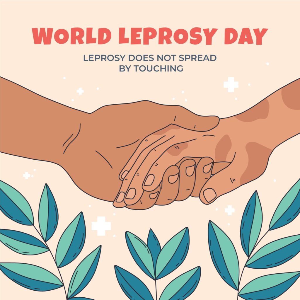 Best Leprosy Treatment