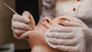 Open Pores Treatment: Effective Home Remedies for Open Pores