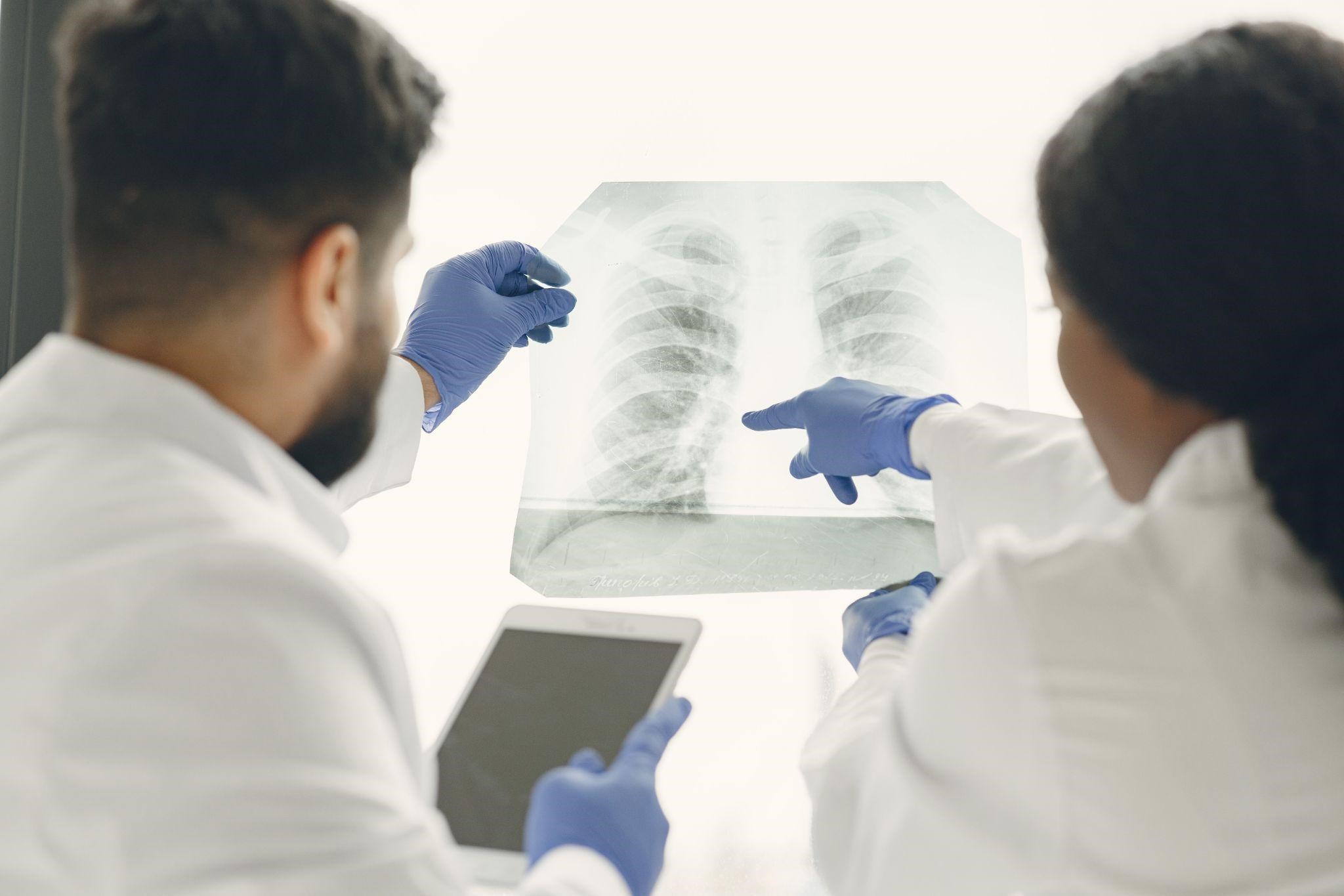 Treating and Managing Tuberculosis: Best Treatment for TB