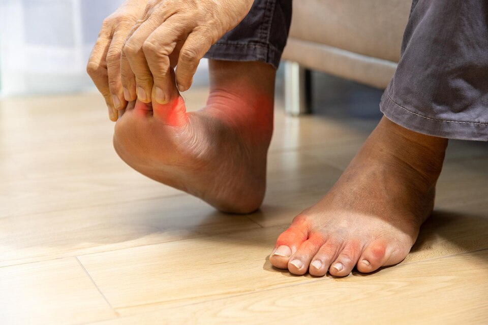 gout treatment