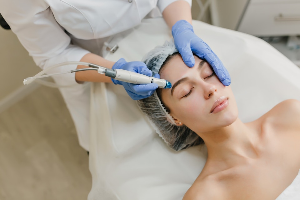 laser treatment for face