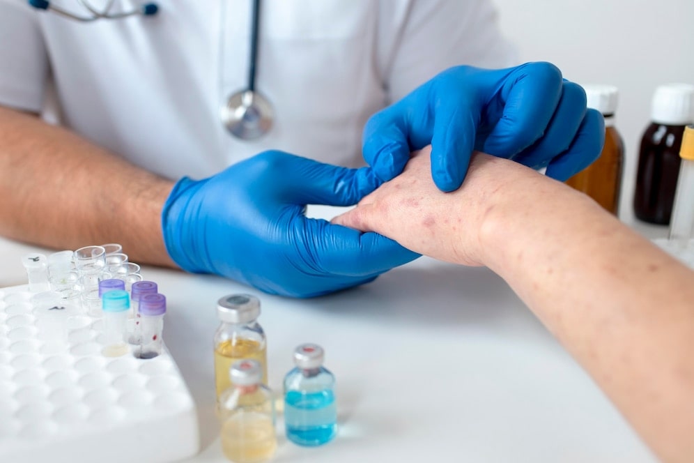 Fungal Infection Treatment image