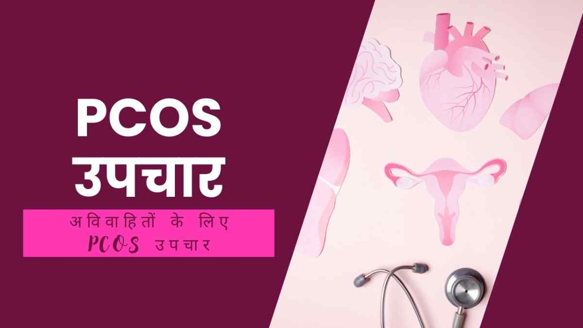 PCOS उपचार – अविवाहितों के लिए PCOS उपचार, PCOS Treatment in Hindi