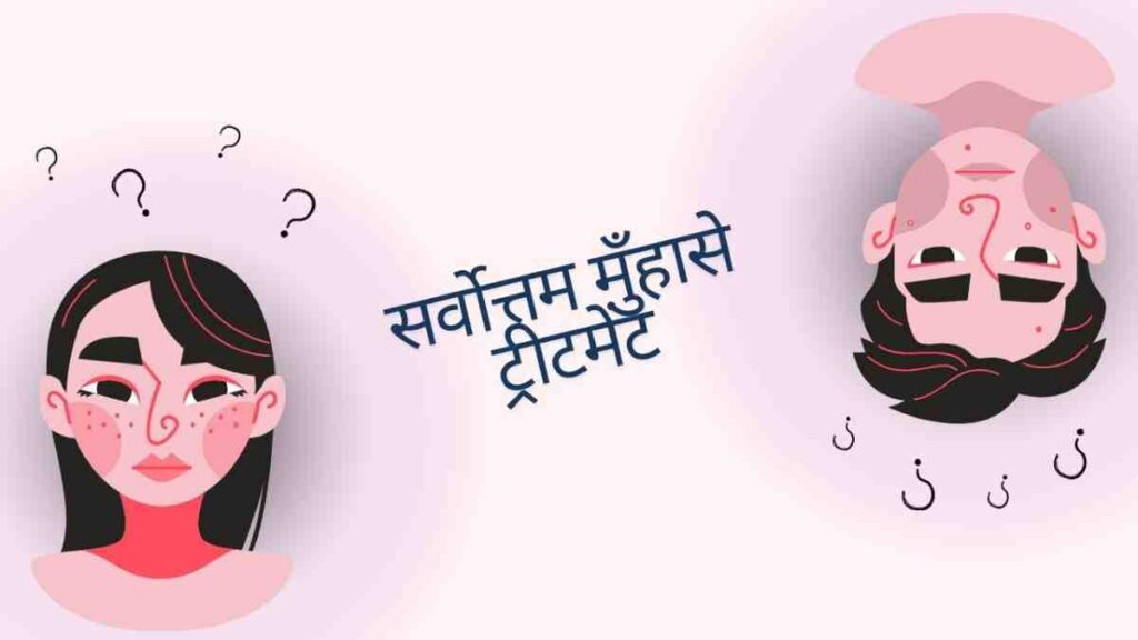 acne treatment in hindi