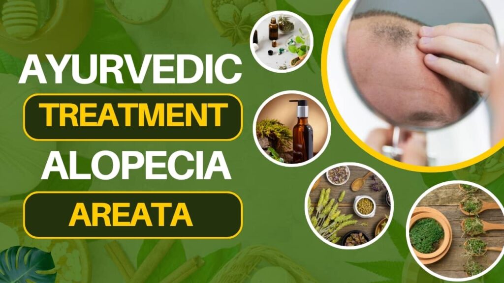 alopecia areata treatment