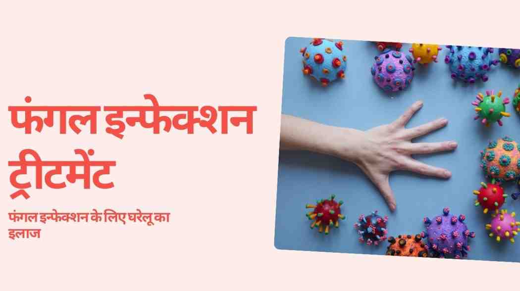 फंगल इन्फेक्शन ट्रीटमेंट: फंगल इन्फेक्शन के लिए घरेलू का इलाज, Fungal Infection Treatment in Hindi