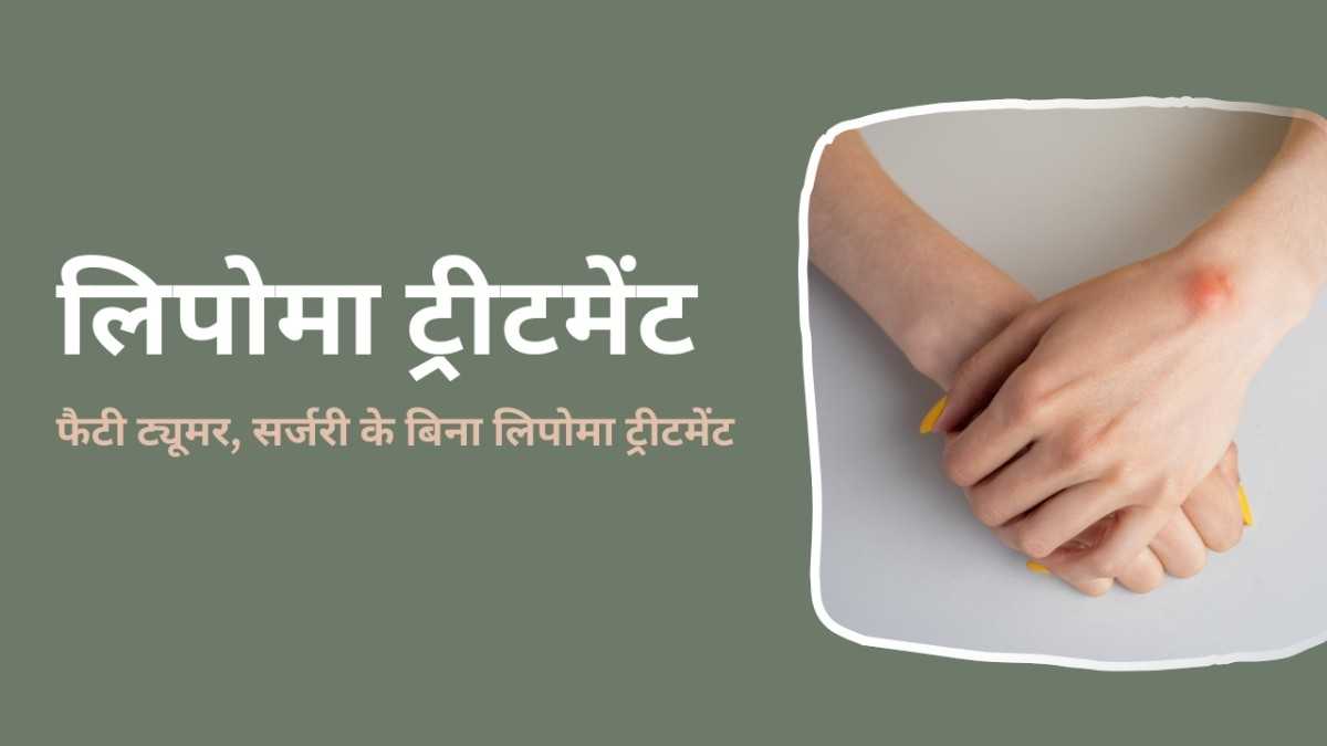 लिपोमा ट्रीटमेंट: फैटी ट्यूमर, सर्जरी के बिना लिपोमा ट्रीटमेंट, Lipoma Treatment in Hindi
