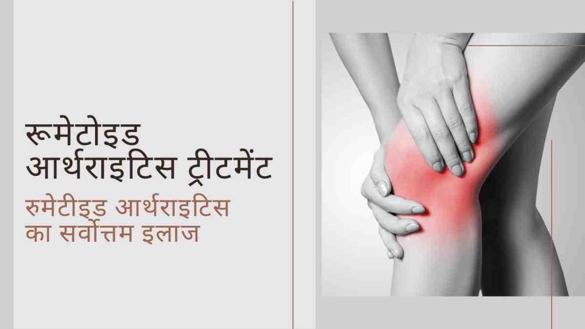 रूमेटोइड आर्थराइटिस ट्रीटमेंट: रुमेटीइड आर्थराइटिस का सर्वोत्तम इलाज, Rheumatoid Arthritis Treatment in Hindi