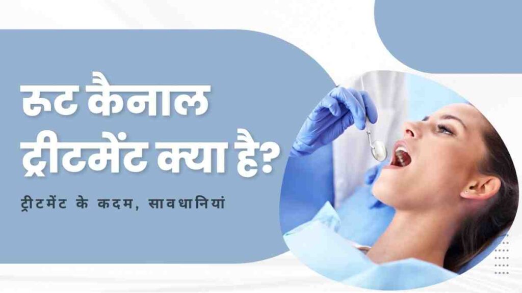root canal treatment in hindi