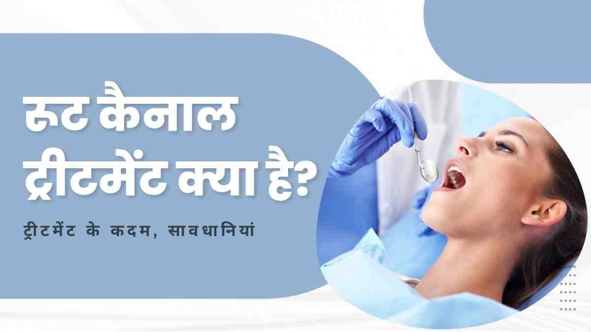 root canal treatment in hindi
