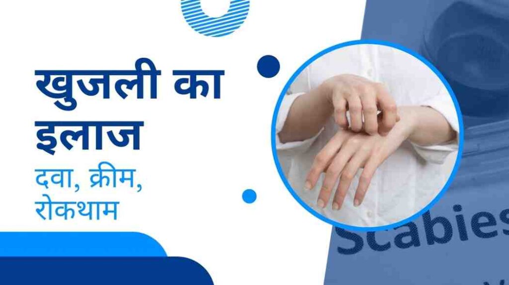 scabies treatment in hindi