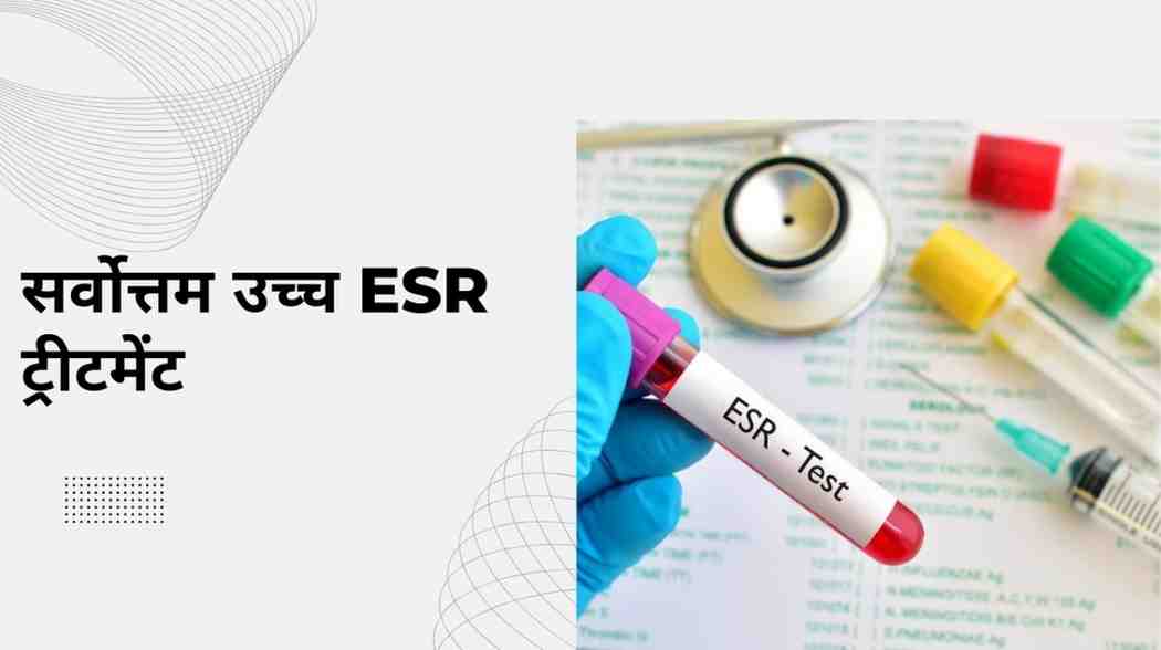 सर्वोत्तम उच्च ESR ट्रीटमेंट: एरिथ्रोसाइट अवसादन दर ट्रीटमेंट, ESR Test in Hindi