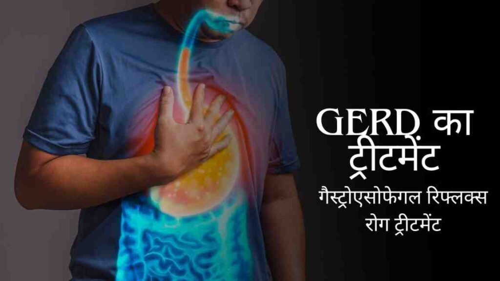 GERD treatment in hindi