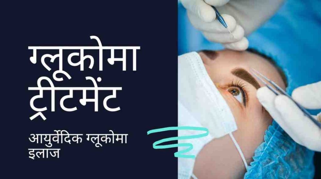 glaucoma treatment in hindi
