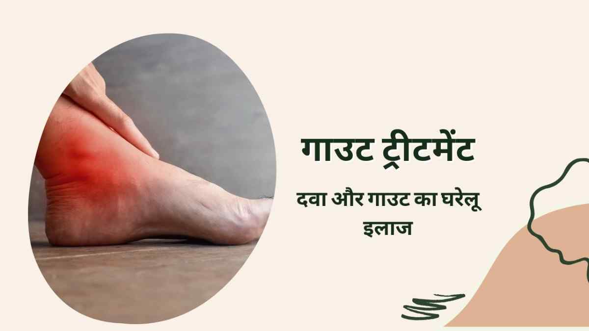 गाउट ट्रीटमेंट: दवा और गाउट का घरेलू इलाज, Gout Treatment in Hindi