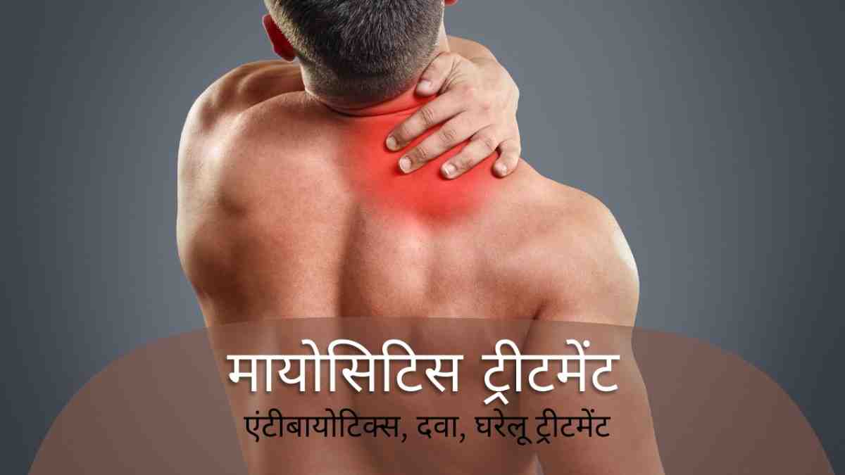 मायोसिटिस ट्रीटमेंट : एंटीबायोटिक्स, दवा, घरेलू ट्रीटमेंट, Myositis Treatment in Hindi