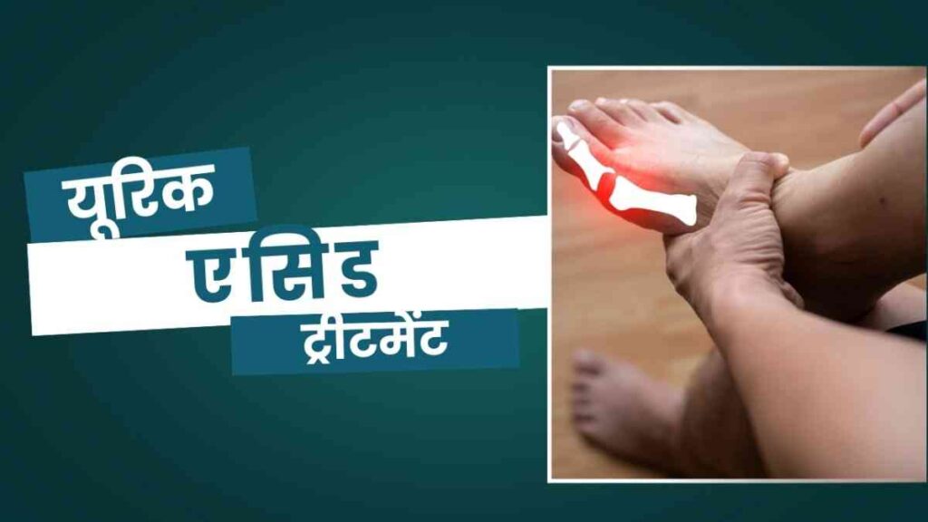 uric acid treatment in hindi