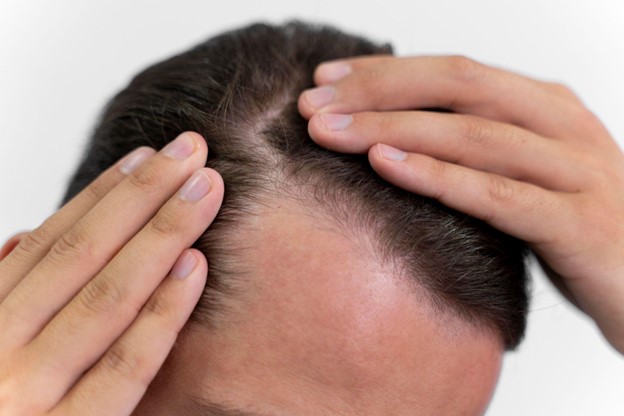 How To Prevent Hair Fall