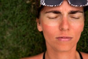 How to Remove Tan from Face? - Home Remedies to Remove Tan
