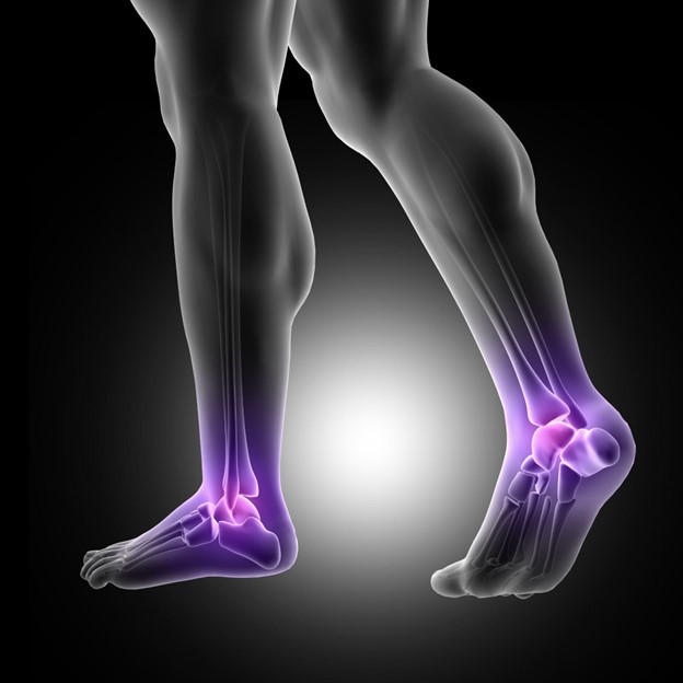 7 Ways To Treat Heel Spurs - By Dr. Jitender Pal Singh | Lybrate