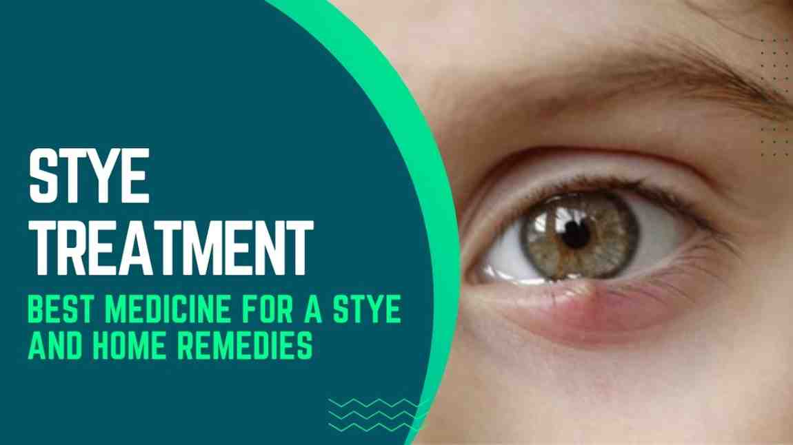 Stye Treatment - Best Medicine and antibiotic for Stye Treatment