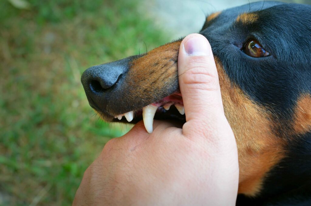 Best Treatment for Dog Bite