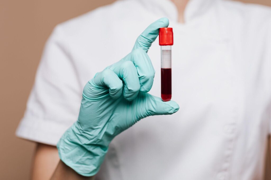 Normal Hemoglobin Level in Female