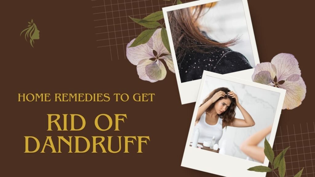 home remedies for dandruff