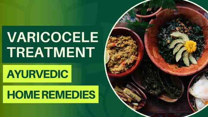 varicocele treatment