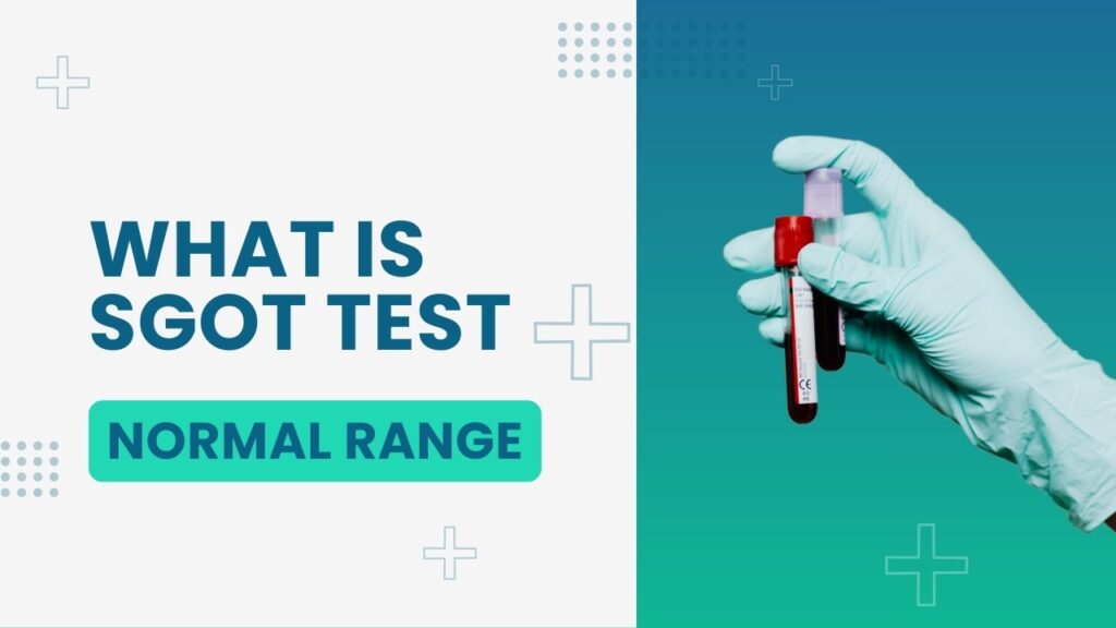 what is SGOT test