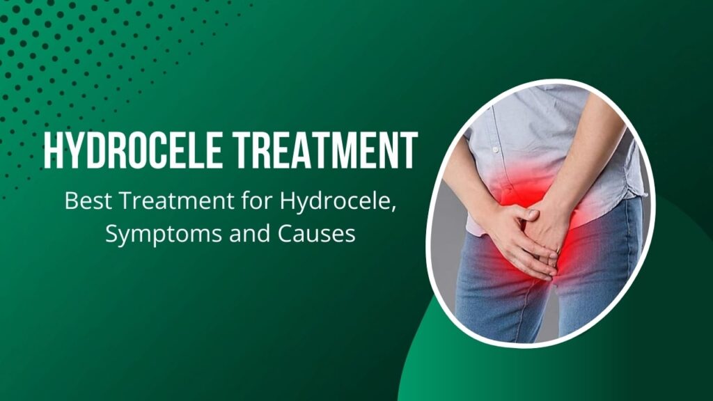 hydrocele treatment