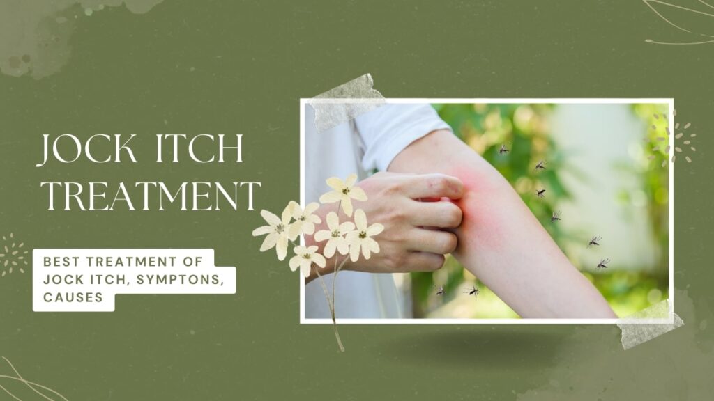 jock itch treatment