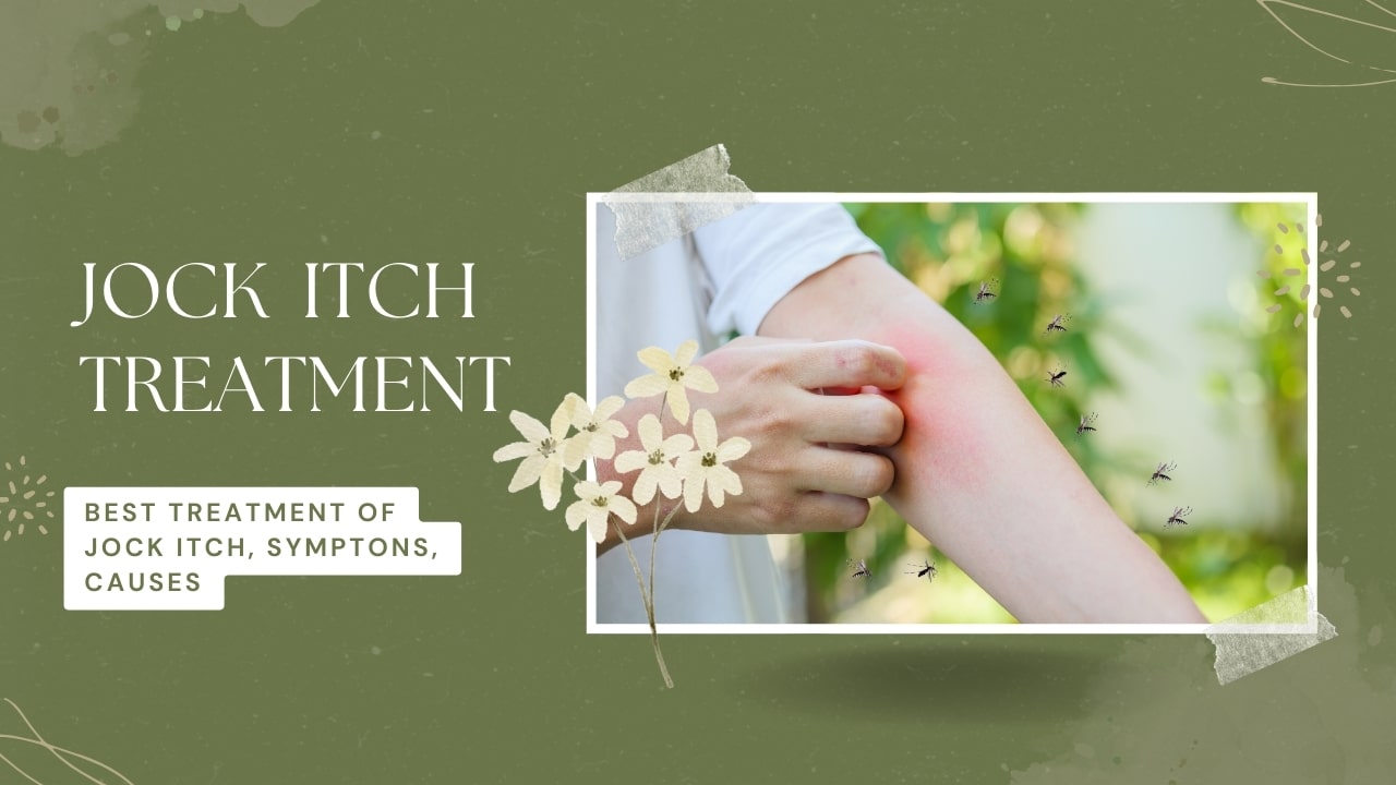 Jock Itch Treatment - Best Treatment of Jock Itch, Symptons
