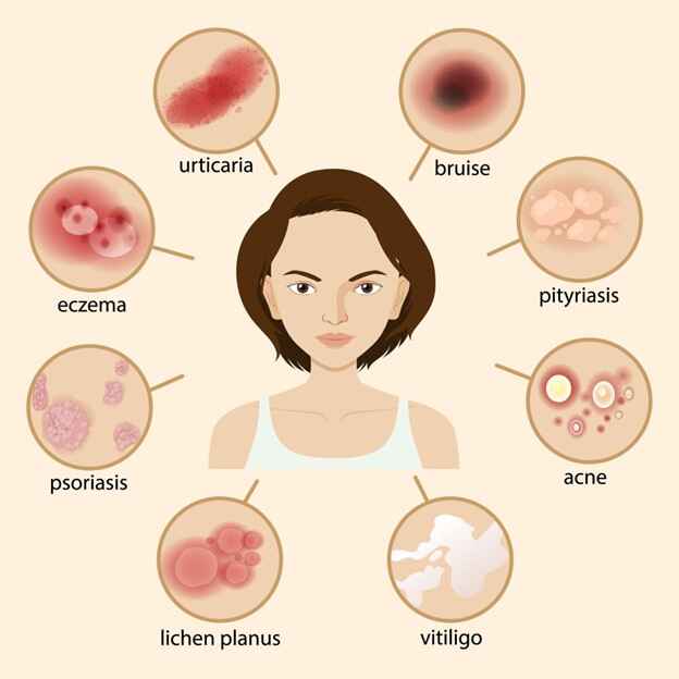  types of skin infections with pictures