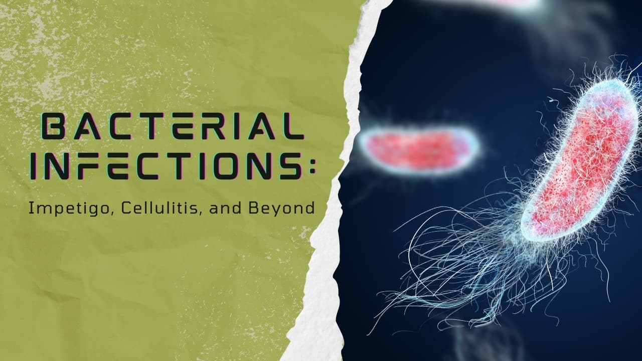 Bacterial Infections: Impetigo, Cellulitis, and Beyond - Medkart Pharmacy Blogs