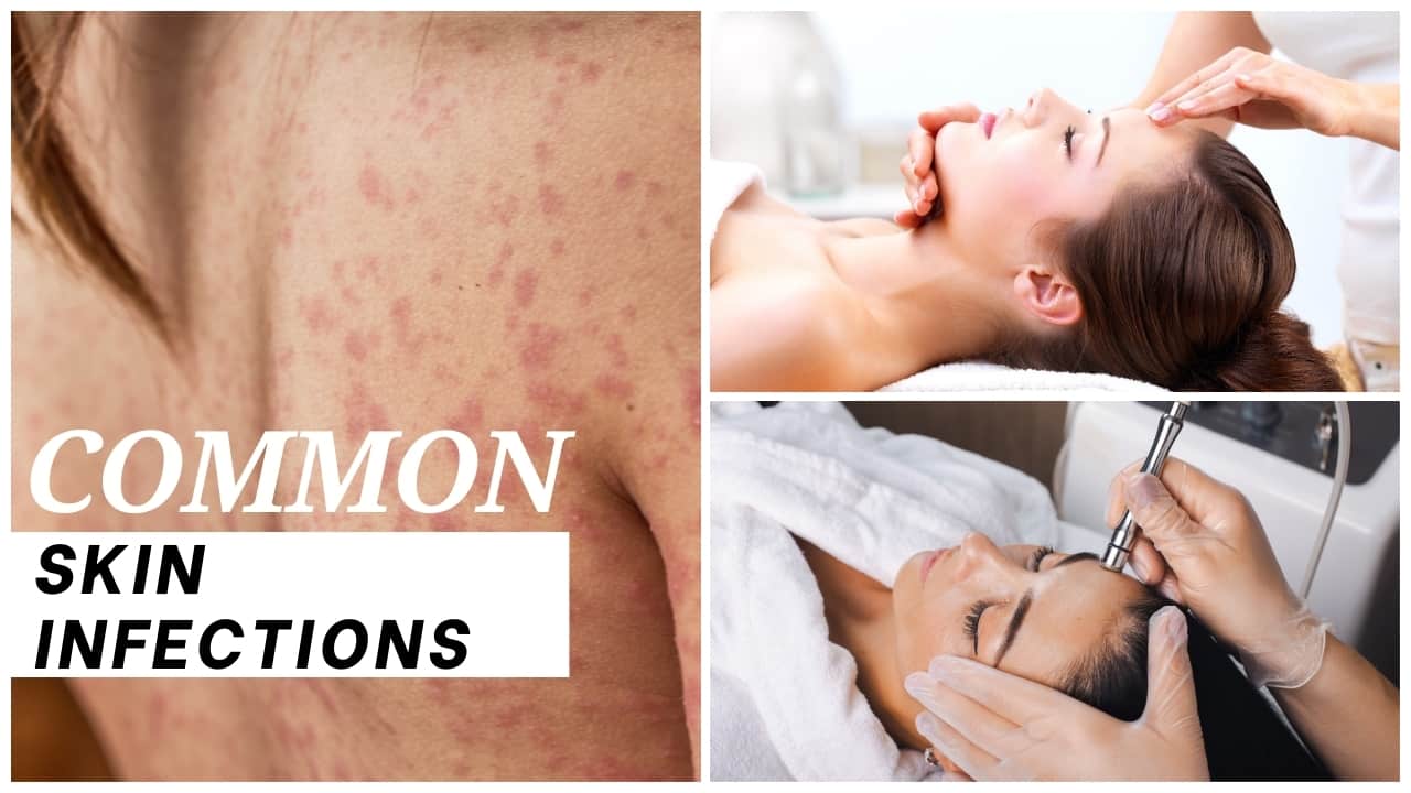 Common Skin Infections: Causes, Symptoms, and Treatment - Medkart Pharmacy Blogs