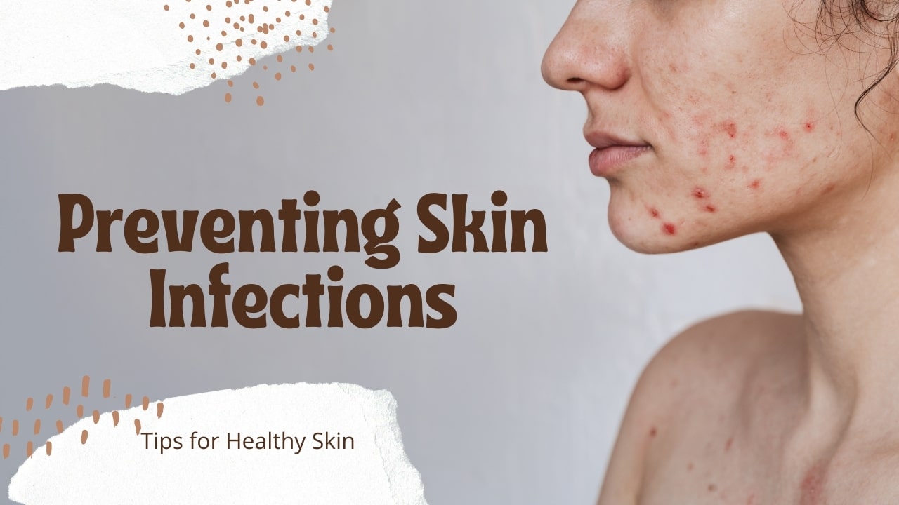 Preventing Skin Infections: Tips for Healthy Skin - Medkart Pharmacy Blogs
