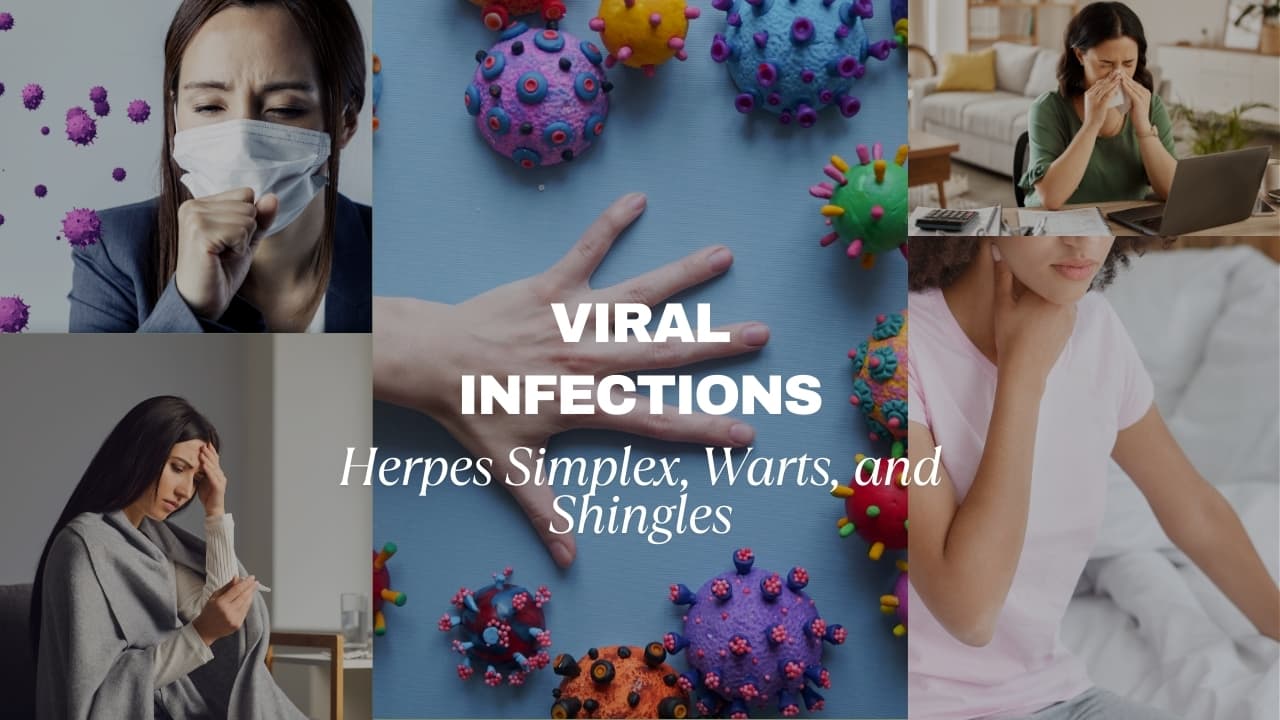 Viral Infections : Herpes Simplex, Warts, and Shingles - Medkart Pharmacy Blogs