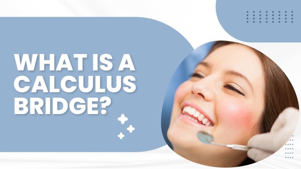 what is a calculus bridge