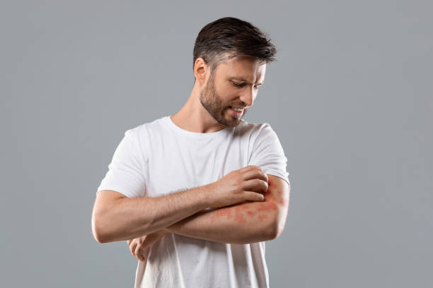 antifungal powder