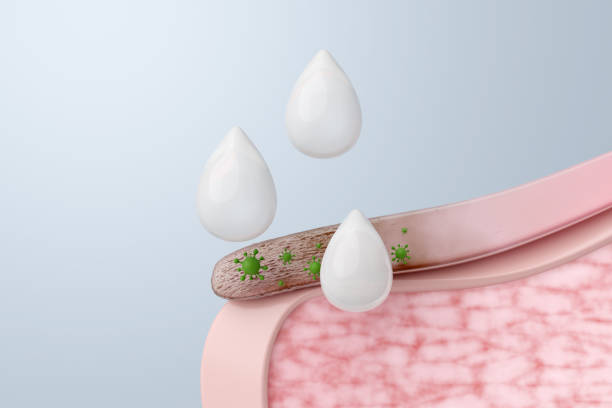 Candid B Antifungal Cream