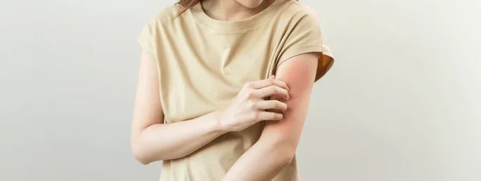 Candid B Antifungal Cream